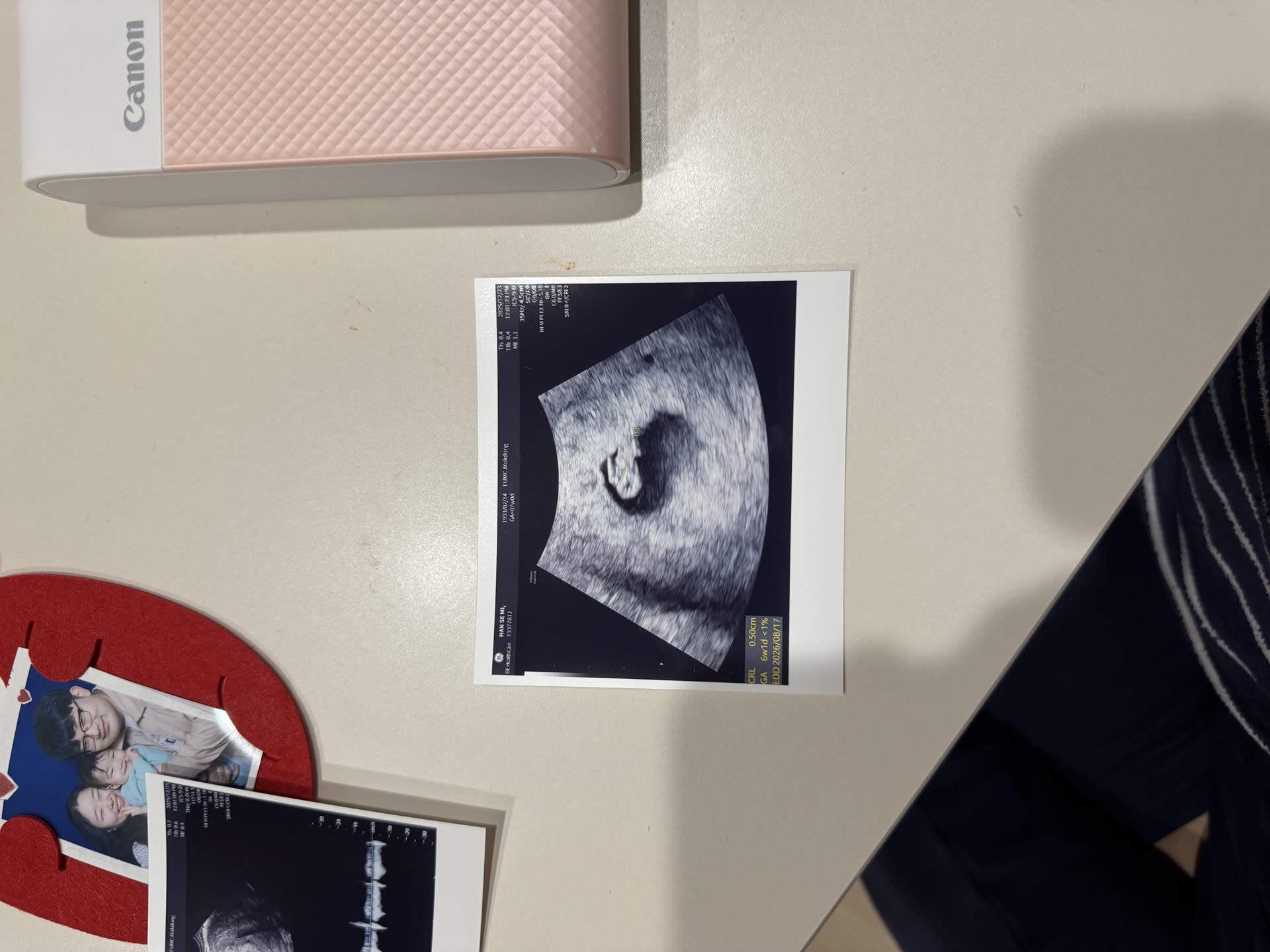 Lucky ultrasound record